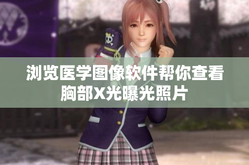 浏览医学图像软件帮你查看胸部X光曝光照片